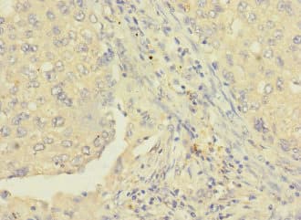 RAB8B Antibody