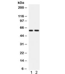 Polyclonal Rabbit anti-Human ATG14 Antibody (IHC, WB)