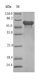 Human FBXO2 Protein (Recombinant GST, N-terminus)