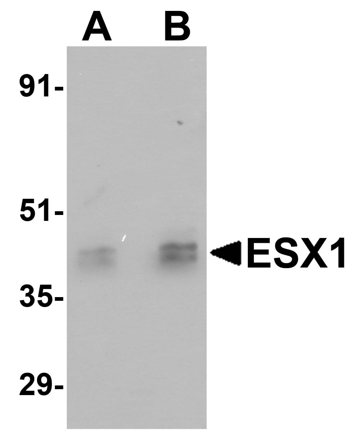 IHC-plus™ Polyclonal Rabbit anti-Human ESX1 Antibody (IHC, IF, WB)