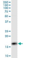 Monoclonal Mouse anti-Human PPP3R1 / Calcineurin B Antibody (clone 4E1, IF, WB)