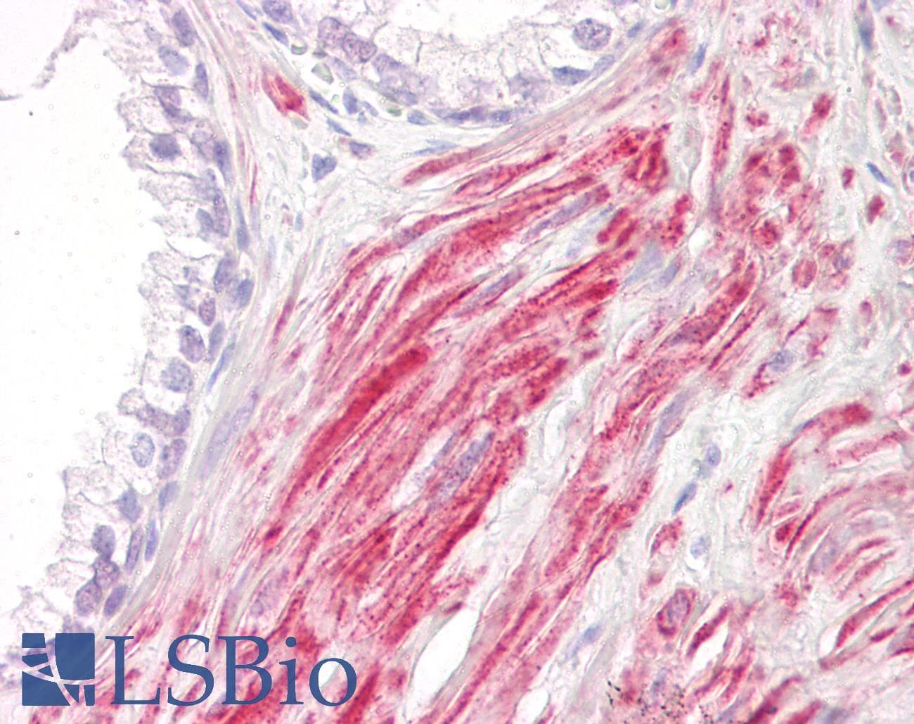 IHC-plus™ IRAK1 / IRAK Antibody (aa175-224)