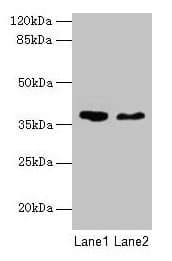 AGA / Aspartylglucosaminidase Antibody (aa206-346)