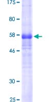 Human PDPN / Podoplanin Protein (Recombinant GST)