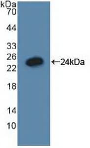 GADD45A / GADD45 Antibody (aa1-165)