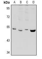 PPP2R2B Antibody