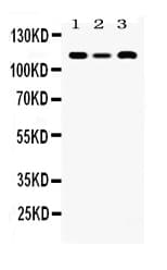 Polyclonal Rabbit anti-Human SMARCA3 / HLTF Antibody (WB)