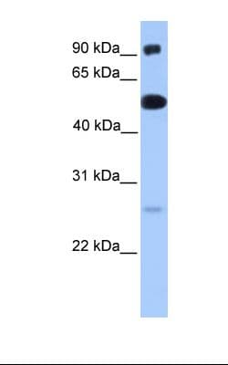 ETV5 / ERM Antibody (N-Terminus)