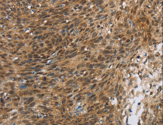 FOXB1 Antibody