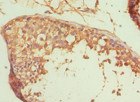 ALDH1A1 / ALDH1 Antibody (aa202-501)