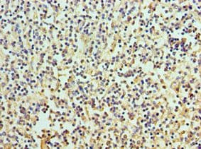 Polyclonal Rabbit anti-Human RICTOR Antibody (aa1-245, IHC)