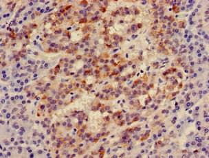 Polyclonal Rabbit anti-Human IRS2 / IRS-2 Antibody (IHC, IF)
