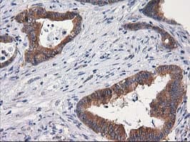 GBA3 / CBG Antibody (clone OTI1F1)