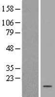 Human JTB / PAR Protein (Over-Expression Lysate Myc-DDK (Flag))