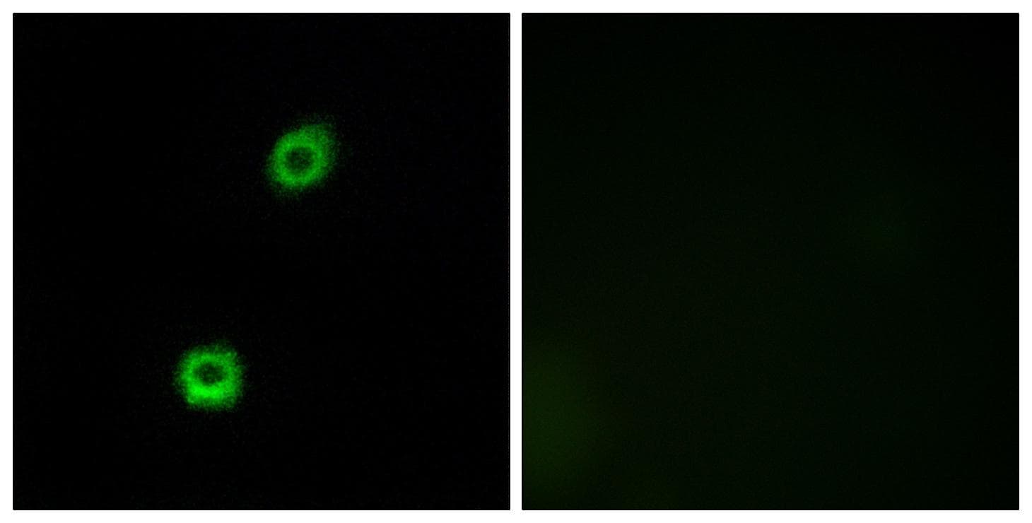 MARCKS Antibody (p158)