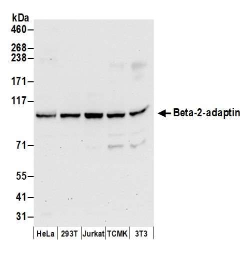 AP2B1 Antibody (aa575-625)