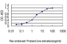 AR / Androgen Receptor Antibody (clone 1G3)