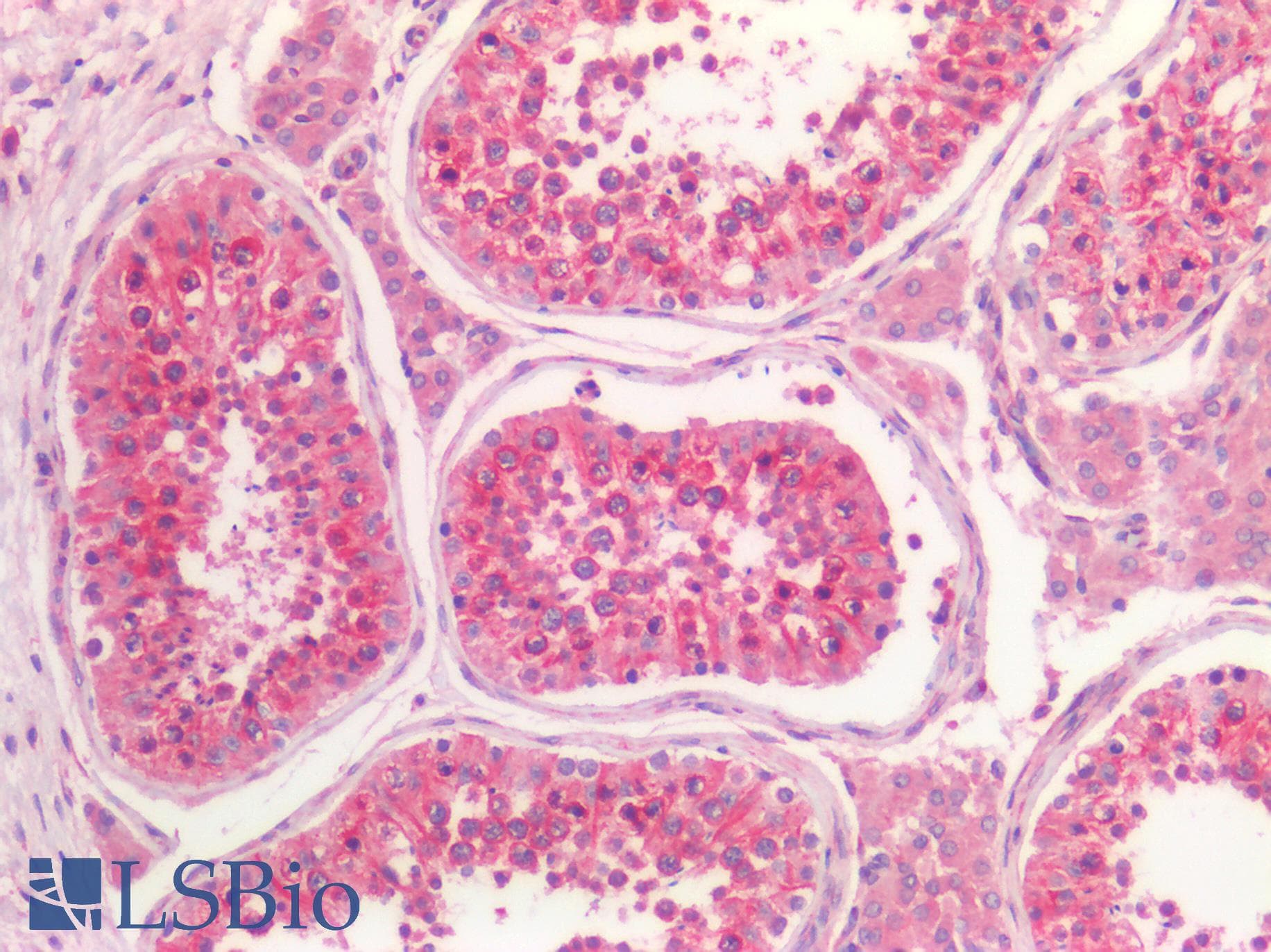 IHC-plus™ Kinesin Heavy Chain / KIF5B Antibody