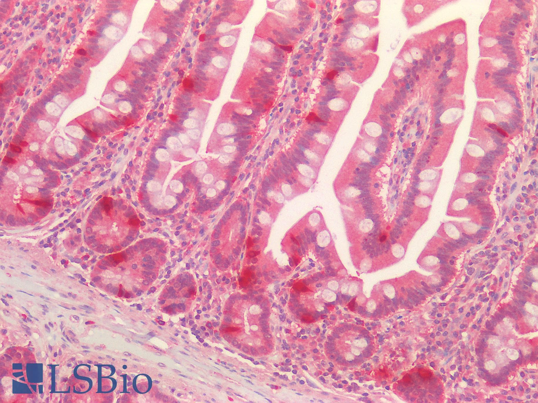 Polyclonal Rabbit anti-Human LOXL1 Antibody (aa369-574, IHC, WB)