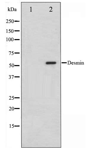 Polyclonal Rabbit anti-Human DES / Desmin Antibody (IHC, WB)