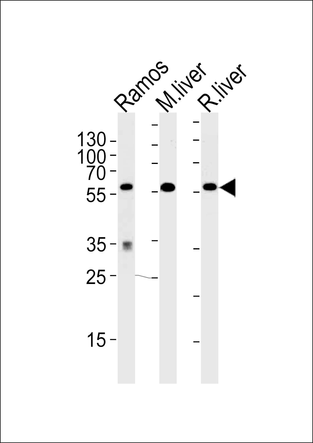 GPI Antibody (aa445-473)