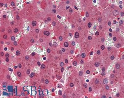 IHC-plus™ Polyclonal Rabbit anti-Human NUDT21 Antibody (IHC)