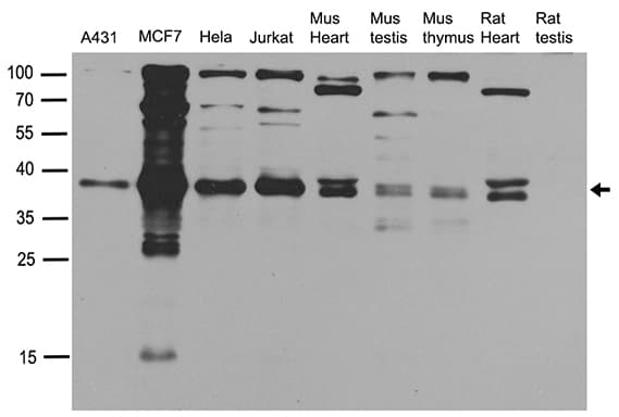 Polyclonal Rabbit anti-Human NHEJ1 / XLF Antibody (WB)