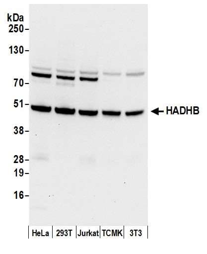 HADHB Antibody (aa225-275)