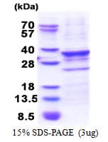 Human CENPQ Protein (Recombinant His)