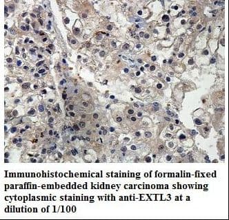 EXTL3 Antibody (aa750-919)