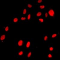 ZEB1 / AREB6 Antibody