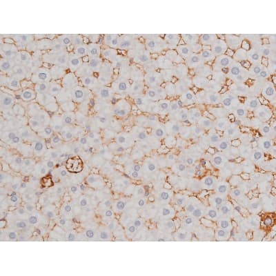 Polyclonal Rabbit anti-Human MAPT / Tau Antibody (phospho-Thr181, IHC, WB)
