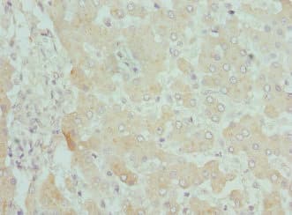 Polyclonal Rabbit anti-Human CPN1 Antibody (IHC)