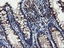DPH2 Antibody (clone OTI4E7)