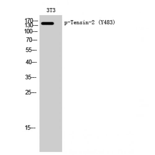Polyclonal Rabbit anti-Human TNS2 / TENC1 Antibody (phospho-Tyr483, WB)