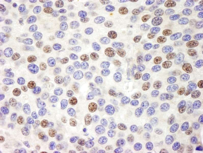 PES1 Antibody (aa535-C-term)