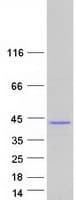 Human GKAP1 Protein (Recombinant Myc-DDK (Flag))