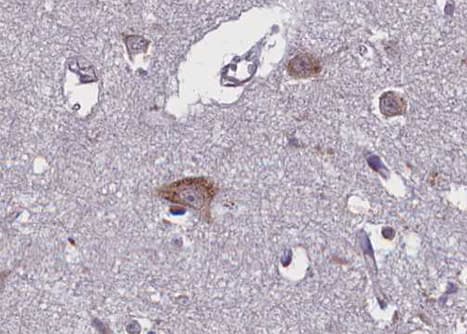 NTRK2 / TRKB Antibody (phospho-Tyr705)