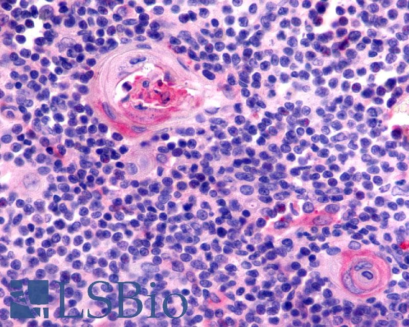 PathPlus™ CCR7 Antibody (C-Terminus)