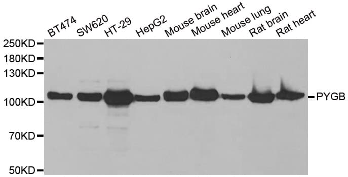 Polyclonal Rabbit anti-Human GPBB / PYGB Antibody (IHC, IF, WB)