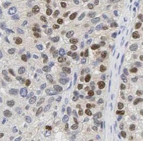 MKI67 / Ki67 Antibody