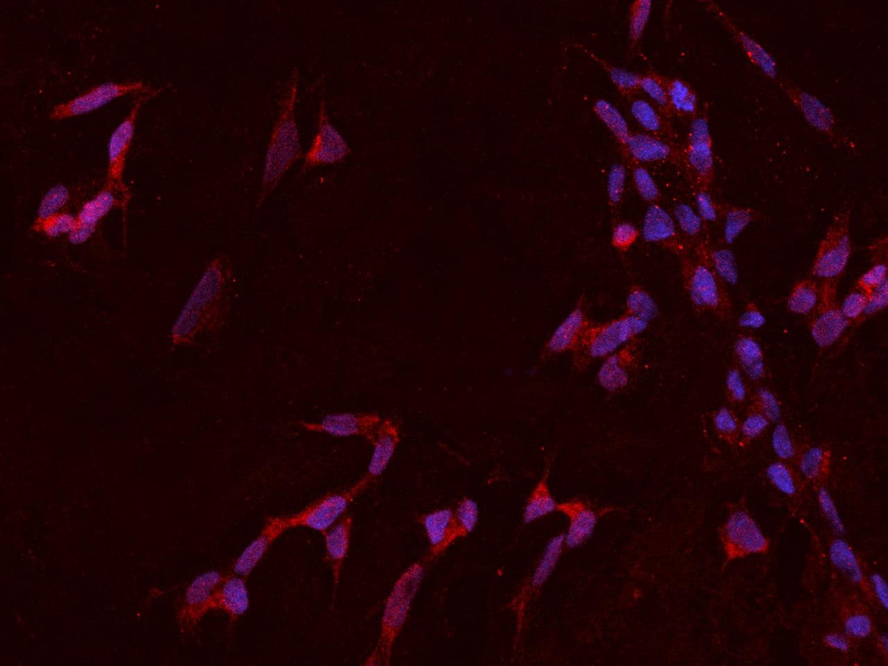HTR2C / 5-HT2C Receptor Antibody