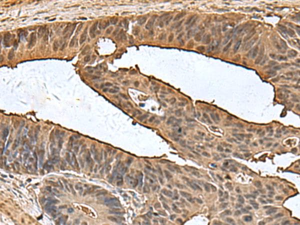 DCTPP1 / XTP3TPA Antibody