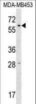 RPUSD2 Antibody (aa80-109)