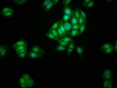 Polyclonal Rabbit anti-Human LACE1 Antibody (IHC, WB)