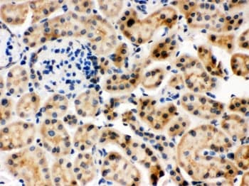 Polyclonal Rabbit anti-Human HSPA8 / HSC70 Antibody (IHC, WB)