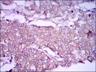 Monoclonal Mouse anti-Human GPC3 / Glypican 3 Antibody (clone 9C2, aa55-200, IHC, IF, WB)