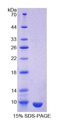 Human SCGB1A1 / Uteroglobin Protein (Recombinant His)