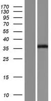 TK2 Protein (Over-Expression Lysate Myc-DDK (Flag))