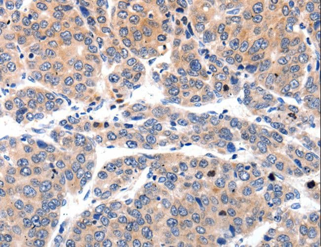 MLC2 / MYL9 Antibody